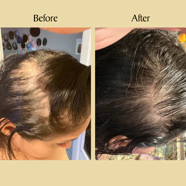 Jamalgota Ayurvedic Hair Growth Powder 100gm